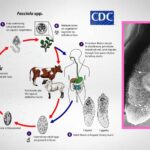 Fascioliasis: Causative agent, Life cycle, Symptoms, Treatment.