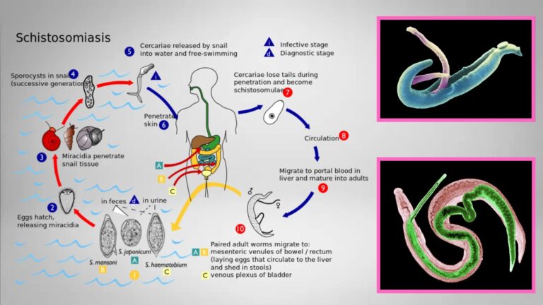 Schistosomiasis Life cycle, Symptoms, Treatment, Prevention.