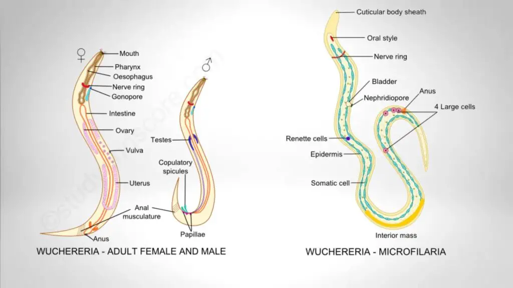 Wuchereria bancrofti and Microfilariae (Embryos)