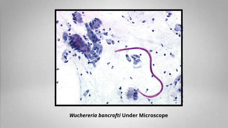 Wuchereria Bancrofti - Morphology, Life Cycle, Epidemiology ...