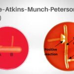 Christie, Atkins, and Munch-Peterson (CAMP) test