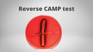 Reverse CAMP test Principle, Procedure, Result