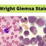 Wright Giemsa Stain Protocol, Principle, Result.