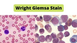 Wright Giemsa Stain – Protocol, Principle, Result.