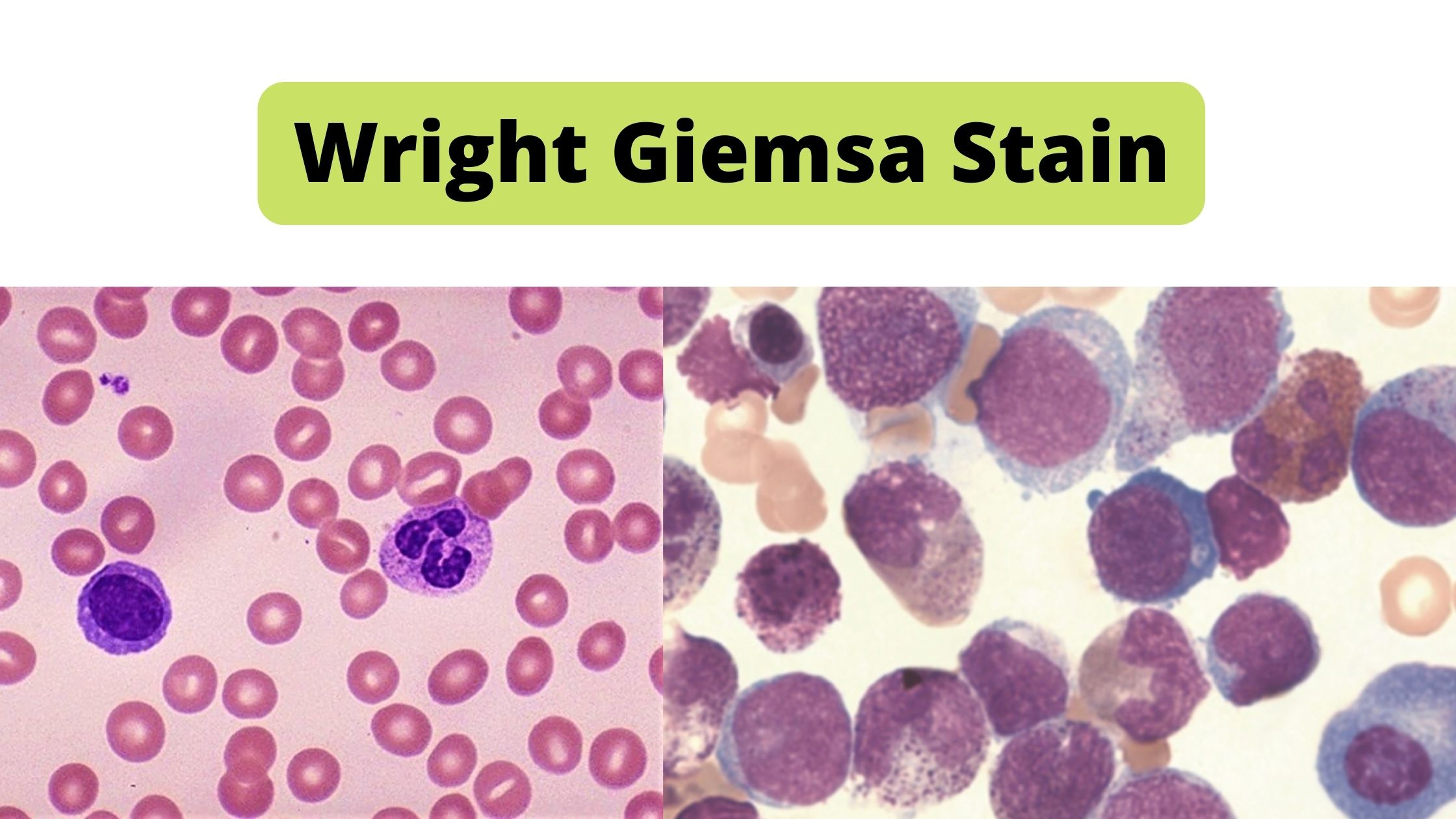 Wright Giemsa Stain Protocol, Principle, Result.