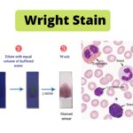 Wright Stain Principle, Procedure, Result