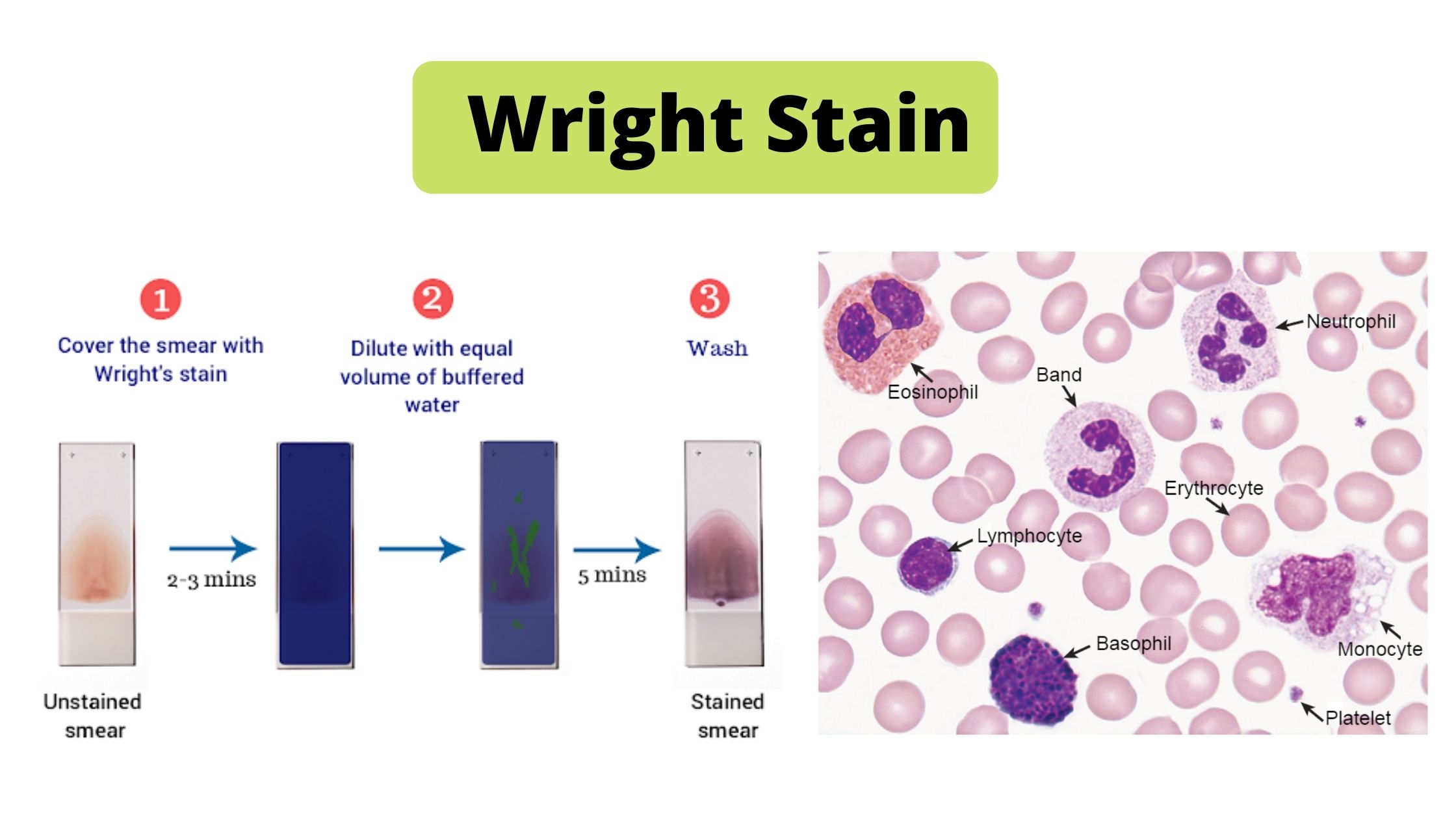 Wright Stain Principle, Procedure, Result