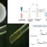Gelatin Hydrolysis Test Purpose, Principle, Procedure, Result.