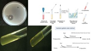 Gelatin Hydrolysis Test – Purpose, Principle, Procedure, Result.