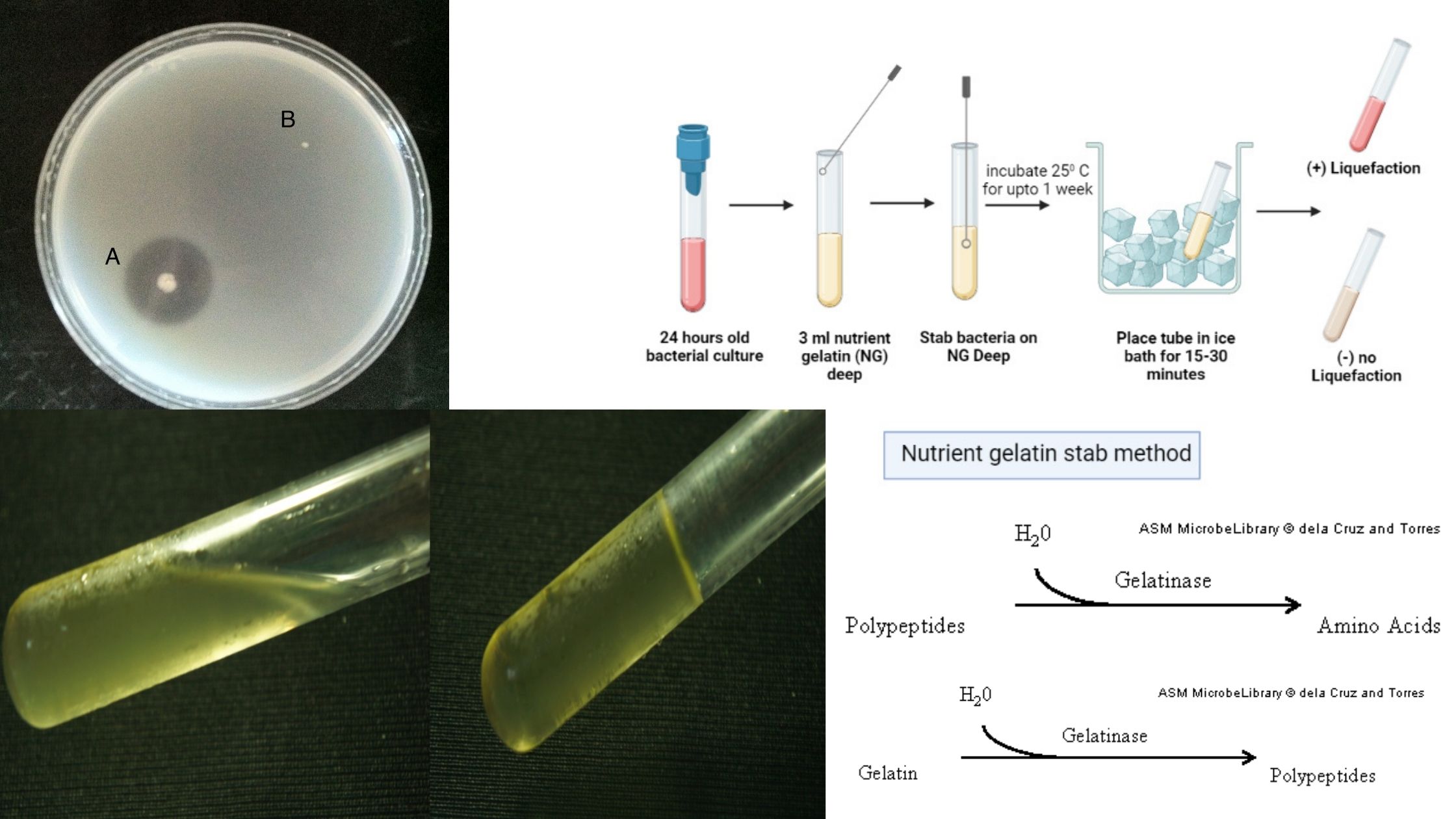 Gelatin Hydrolysis Test Purpose, Principle, Procedure, Result.