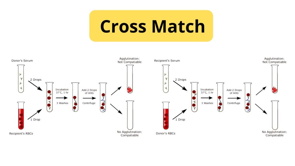 Blood Cross Matching - Principle, Procedure, Result. - Biology Notes Online