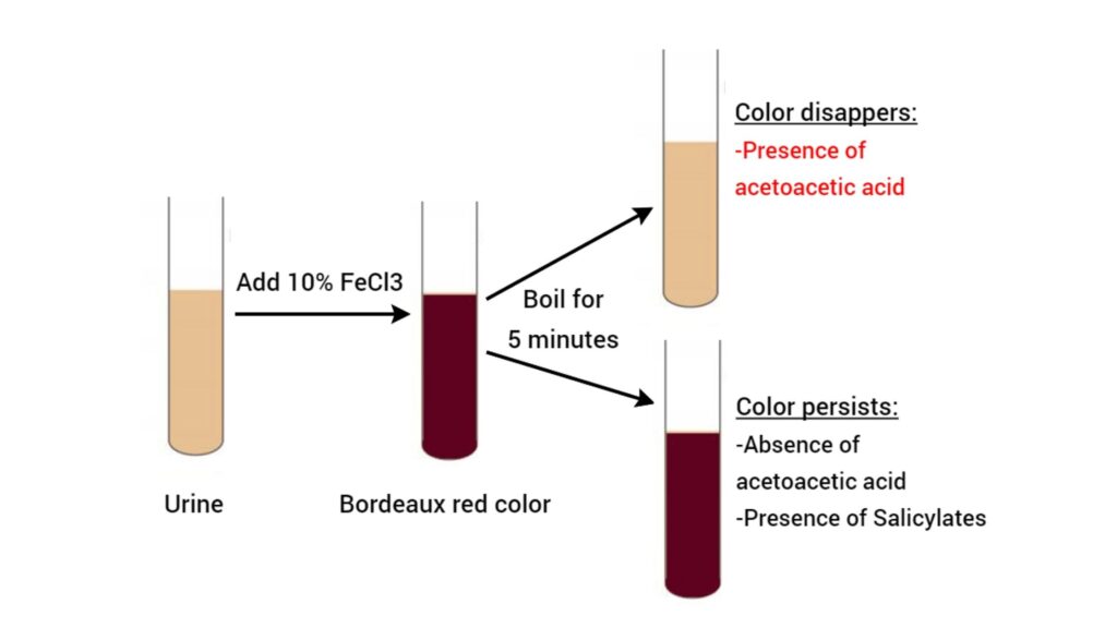 Gerhardt's test Principle, Procedure, Result - Biology Notes Online