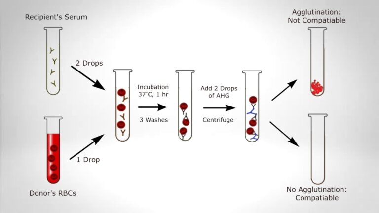 Blood Cross Matching - Principle, Procedure, Result. - Biology Notes Online