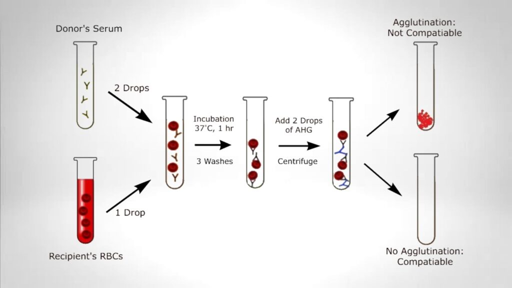 Blood Cross Matching - Principle, Procedure, Result. - Biology Notes Online