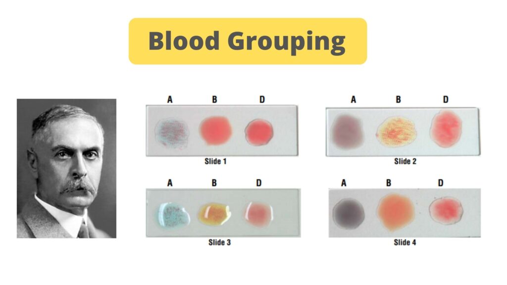 experiment on blood grouping