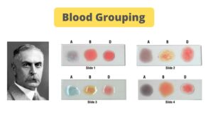 Blood Grouping Test – Principle,  Procedure, Result