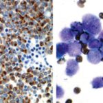 Myeloperoxidase staining