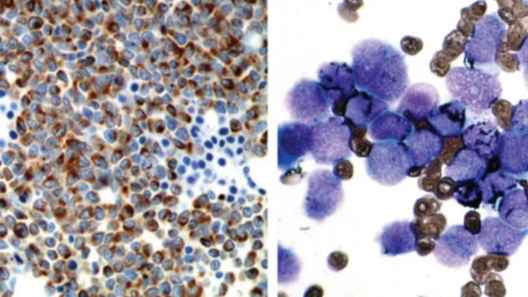 Myeloperoxidase staining
