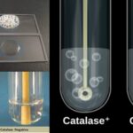 Catalase Test Principle, Procedure, Result and Application.