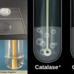 Catalase Test Principle, Procedure, Result and Application.
