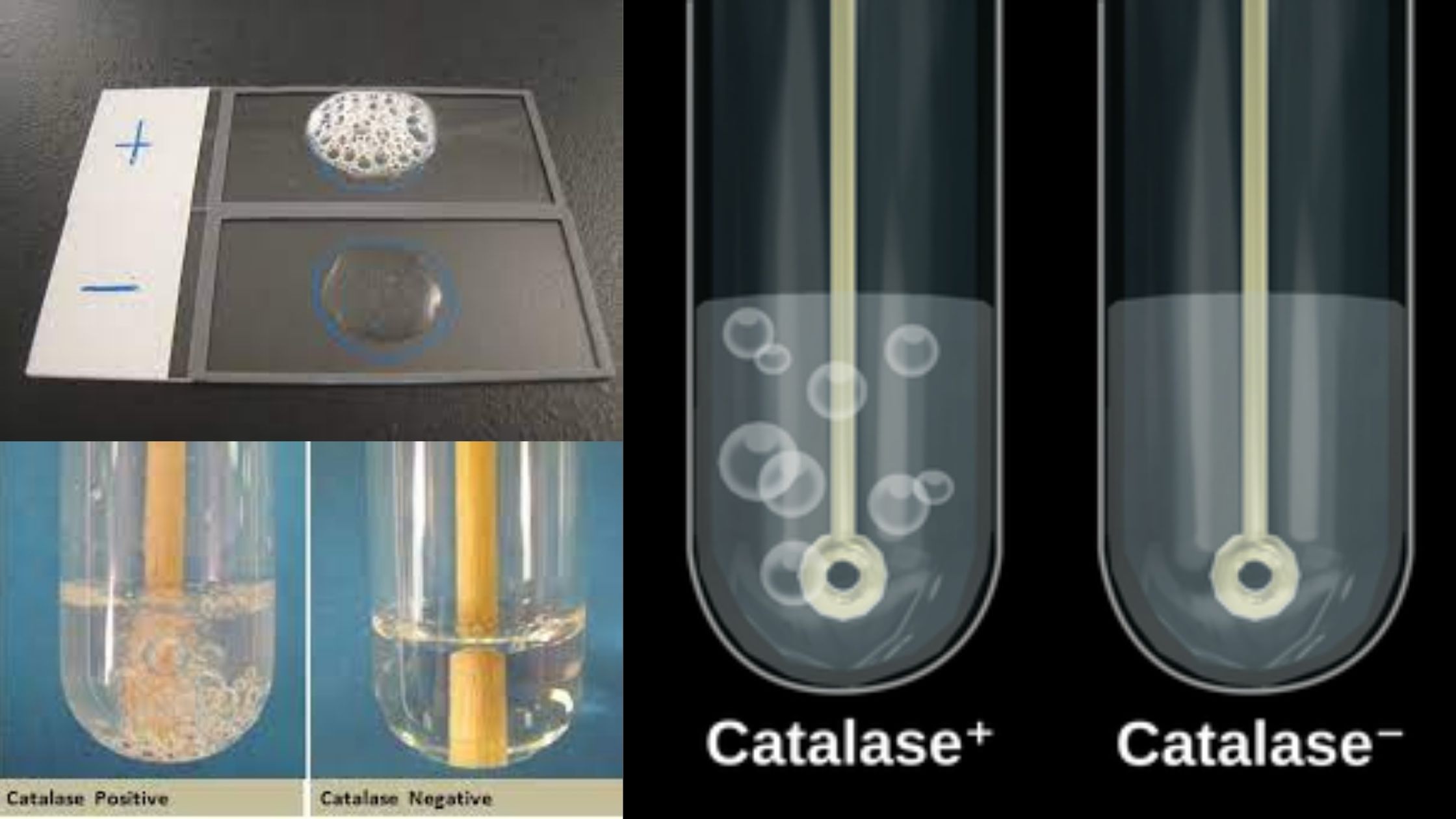 Catalase Test Principle, Procedure, Result and Application.