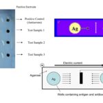 Counter Current Immunoelectrophoresis