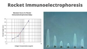 Rocket Immunoelectrophoresis – Definition, Principle, Procedure, Result, Application