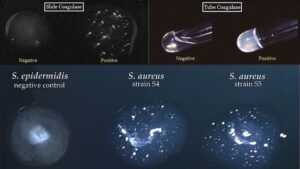 Coagulase Test – Principle, Procedure, Application, Result.