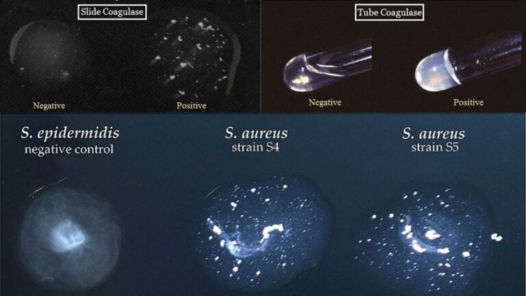 Coagulase Test Principle, Procedure, Application, Result.