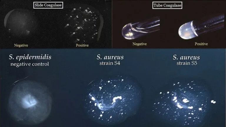 Coagulase Test Principle, Procedure, Application, Result.