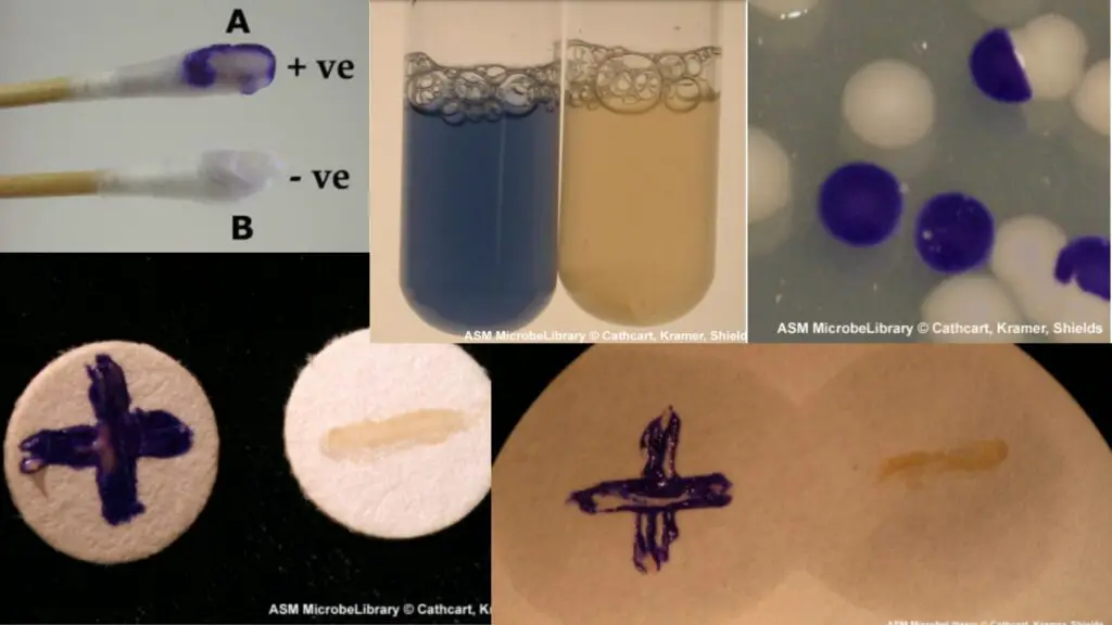 Oxidase Test - Definition, Principle, Procedure, Result, Application ...