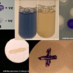 Oxidase Test Definition, Principle, Procedure, Result, Application