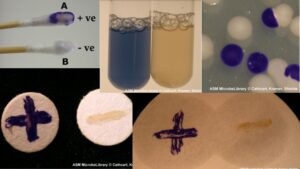 Oxidase Test – Definition, Principle, Procedure, Result, Application