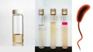 Peptone Water – Principle, Composition, Preparation, Uses