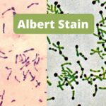 Albert stain Principle, Procedure, Result