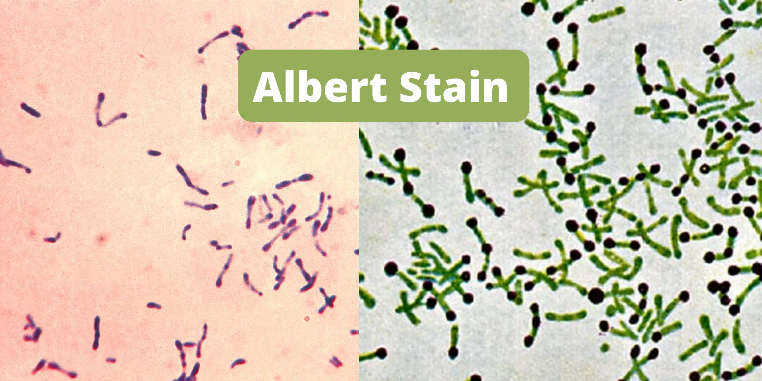 Albert stain Principle, Procedure, Result