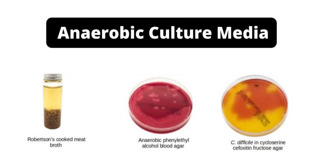 Anaerobic Culture Media - Examples, Definition - Biology Notes Online