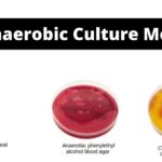 Anaerobic Culture Media Examples, Definition