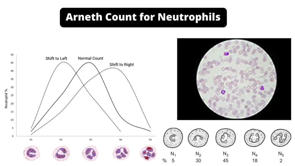 Arneth Count for Neutrophils - Principle, Procedure. - Biology Notes Online