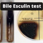 Bile Esculin Test Principle, Procedure, Result, and application.
