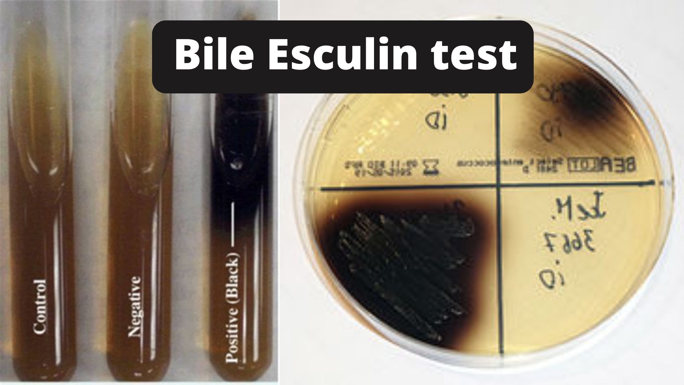 Bile Esculin Test Principle, Procedure, Result, and application.