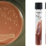 Chocolate Agar Media Principle, Composition, Preparation, Result