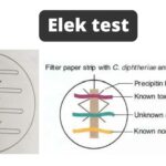 Elek test Principle, Procedure, Result