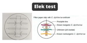 Elek test – Principle, Procedure, Result