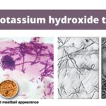 KOH Test (Potassium hydroxide test) Principle, Procedure, Results, Uses