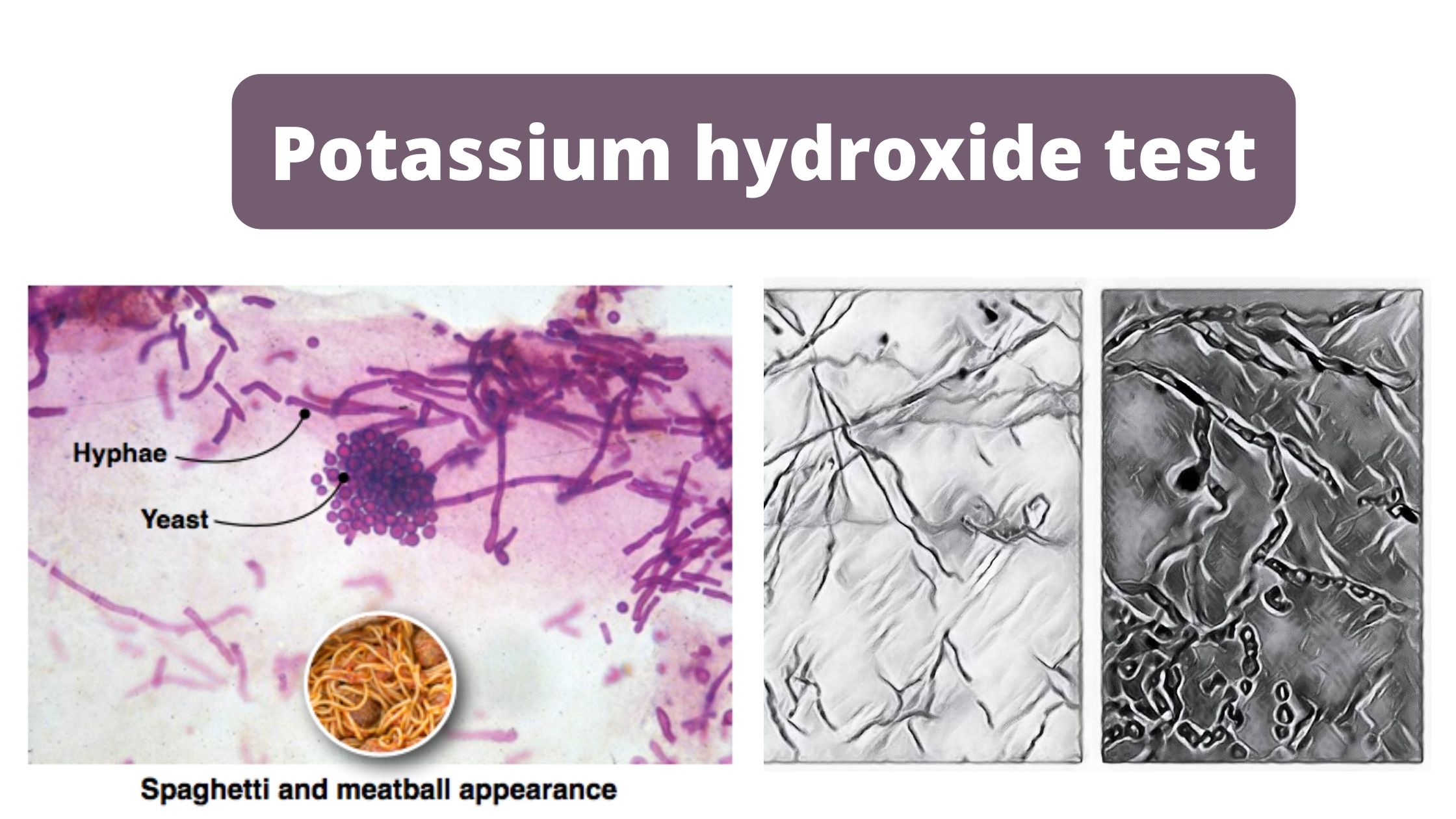 KOH Test (Potassium hydroxide test) Principle, Procedure, Results, Uses