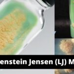 Lowenstein Jensen (LJ) Media Composition, Preparation, Uses