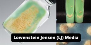 Lowenstein Jensen (LJ) Media – Composition, Preparation, Uses