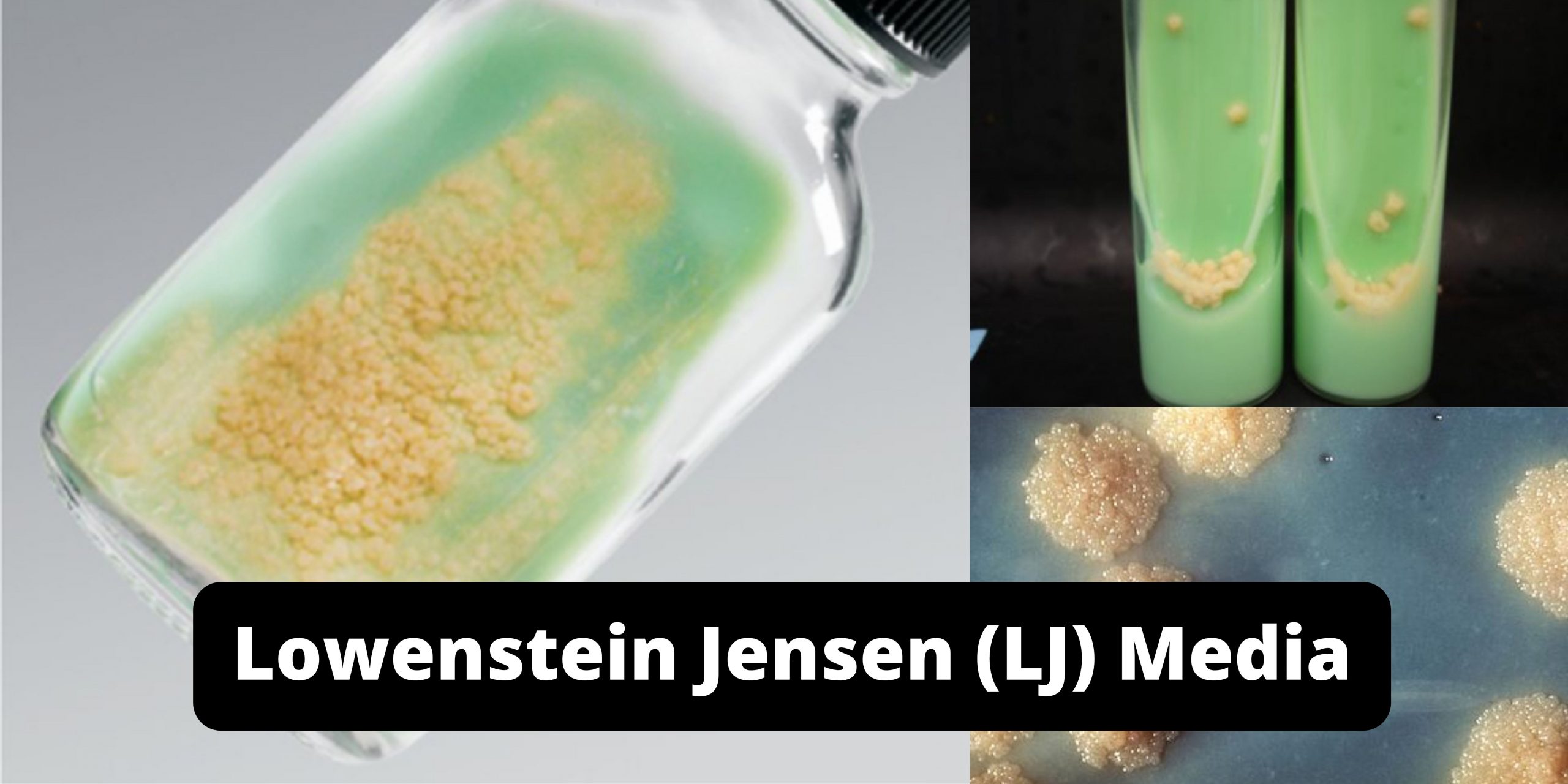 Lowenstein Jensen (LJ) Media Composition, Preparation, Uses