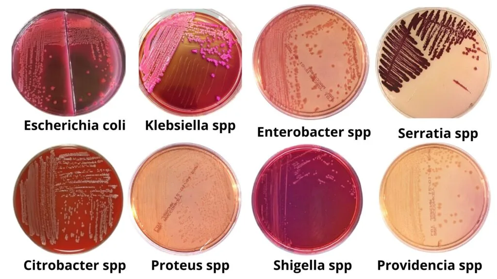 Morphology of bacterial colony on MacConkey Agar